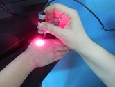 Qi, Clinica acupunctura