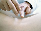 Qi, Clinica acupunctura
